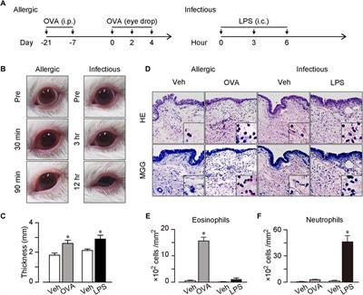 Production profile of lipid mediators in conjunctival lavage fluid in allergic and infectious conjunctivitis in guinea pigs